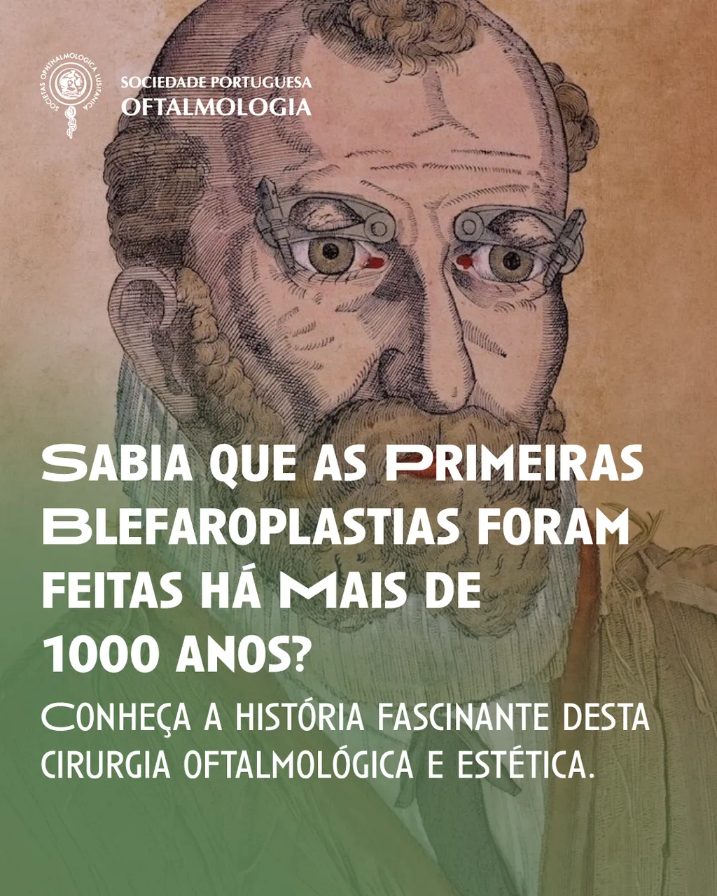 As primeiras blefaroplastias da História