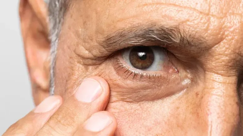 Cuidados a ter no verão com a saúde ocular