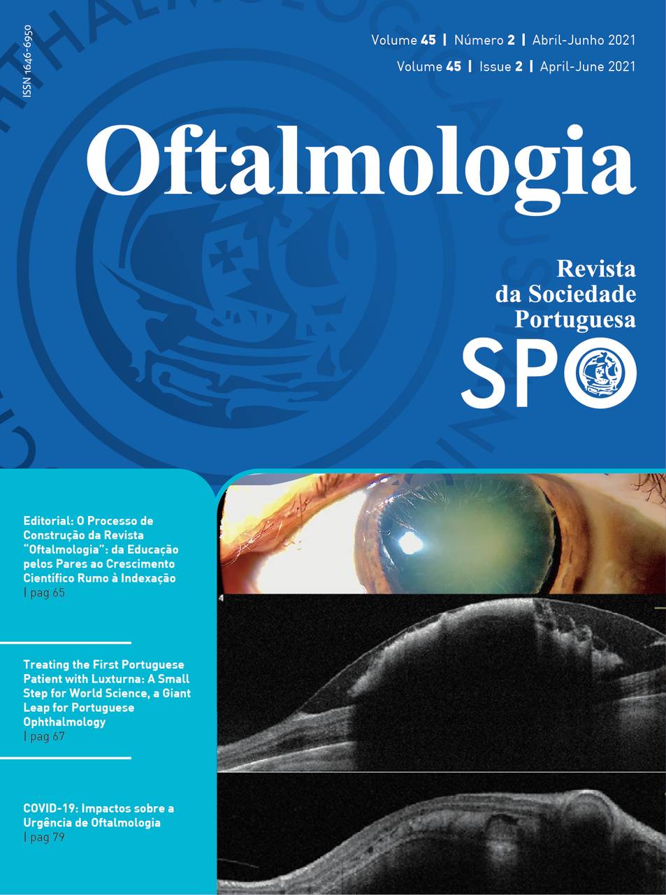 Revista Sociedade Portuguesa de Oftalmologia